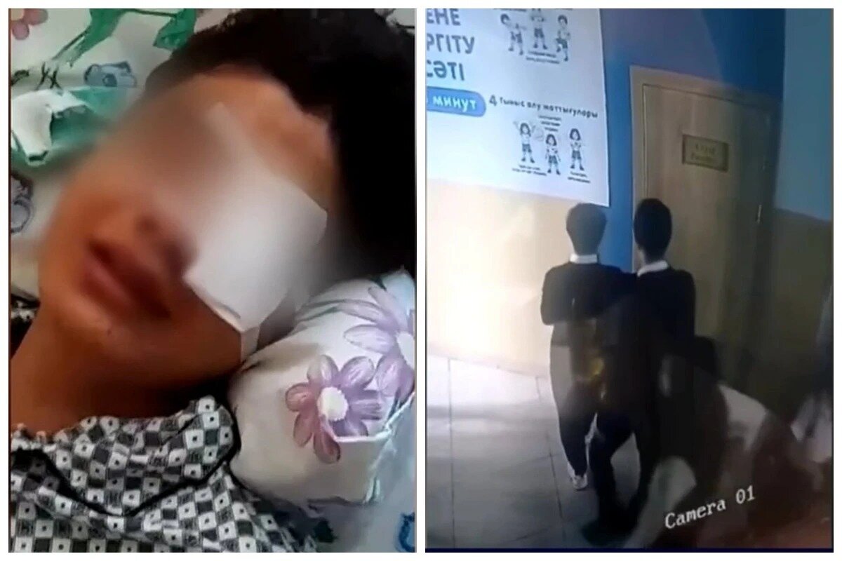 В Таразе школьник лишился глаза после драки